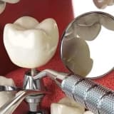 Dental İmplant