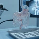 ERCP YÖNTEMİ