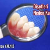 Dişetleri neden kanar ?