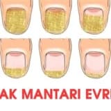 Mantarlı Tırnak