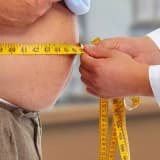 Tüp Mide (Sleeve Gastrektomi)