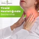 Tiroid Hastalarında Beslenme