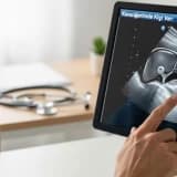 Karaciğerimde Kist Var: Ameliyat Olmalı mıyım?