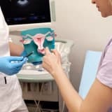 Endometrial hiperplaziye yaklaşım
