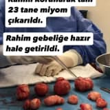 GENÇ VE ÇOCUK SAHİBİ OLMAK İSTEYEN HASTALARDA RAHİM KORUYUCU MİYOM AMELİYATI