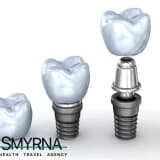 All on 4 Implant Tedavisi Nedir?
