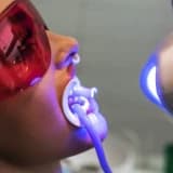 Diş Beyazlatma İşleminin Yan Etkileri