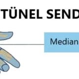 KARPAL TÜNEL SENDROMU, KTS