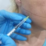 Bruksizm (Diş Sıkma) Nedir? Bruksizm Belirtileri ve Tedavisi
