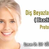 Diş Beyazlatma ( Bleaching ) Protokolü