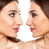 Koruyucu Rinoplasti (Preservation Rhinoplasty) Nedir?