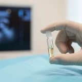 Amniyosentez korkulması gereken bir test midir?