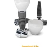 İmplant Diş Uygulamaları