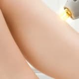 kılcal damar problemi