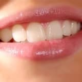 Adeziv sistem ( bonding )