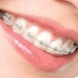 Ortodonti ve çene hastalıkları