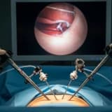 Laparoskopik histerektomi nedir?