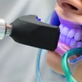 ✨ Diş Beyazlatma Hakkında Doğru Bilinen Yanlışlar