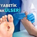 Diyabetik Ayak Bakımı Neden Önemlidir?