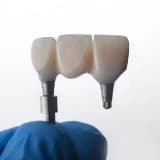 İmplant Yapılırken Ağrı Hissedilir mi? İmplant Tedavisi Ağrılı Bir İşlem midir?