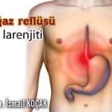 Boğaz reflüsü Asit larenjiti