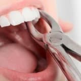 Çekim sonrası dikkat edilecekler