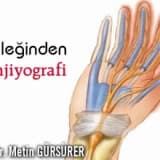El bileğinden anjiyografi