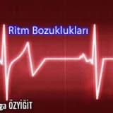 Ritm Bozuklukları