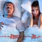 Sleep Apnea (uykuda solunum durması) nedir ?