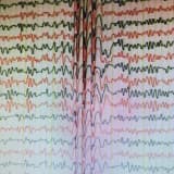 Eeg Neden Önemlidir?