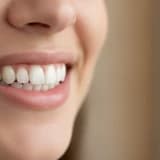 Porselen Lamina Nedir?