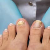 Ayak Tırnağı Neden Etten Ayrılır? 😳💅 Tırnak Düşecek mi?