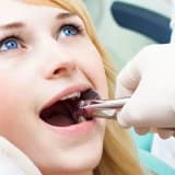 Diş Çekiminden Sonra Nelere Dikkat Edilmelidir?