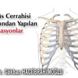 Göğüs Cerrahisi Tarafından Yapılan Operasyonlar