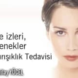 Akne izleri, Gözenekler ve Kırışıklık Tedavisi