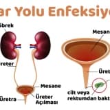 İDRAR YOLU İLTİHABI
