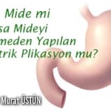 Tüp mide mi yoksa mideyi kesmeden yapılan gastrik plikasyon mu?