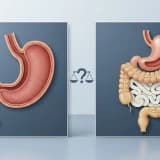 Tüp Mide mi Gastrik Bypass mı?