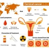 HPV Testleri ve Smear Testi