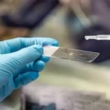 SMEAR TESTİNDE ASCUS ÇIKMASI
