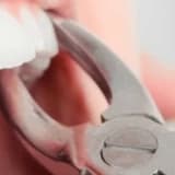 Kanal Tedavi Sonrası Dikkat Edilmesi Gerekenler