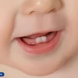 Diş Çıkarma Dönemleri