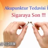 Akupunktur tedavisi ile sigaraya son !!!