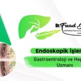 Reflü (Gastroözofageal Reflü Hastalığı – GÖRH): Mide Yanması, Göğüste Yanma, Ağıza Acı Su Gelmesi Gibi Belirtiler ve Yaşam Tarzı Değişiklikleri ile Tedavisi – 1