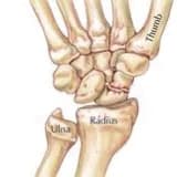 Skafoid kırığı nedir ?