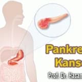Pankreas kanseri