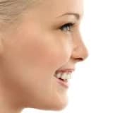 RHİNOPLASTİ