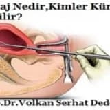 Kürtaj Nedir,Kimler Kürtaj olabilir?