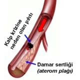 KOLESTEROL KONUSUNDA DOĞRULAR NEDİR ?