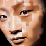 vitiligo, nedenleri ve tedavisi